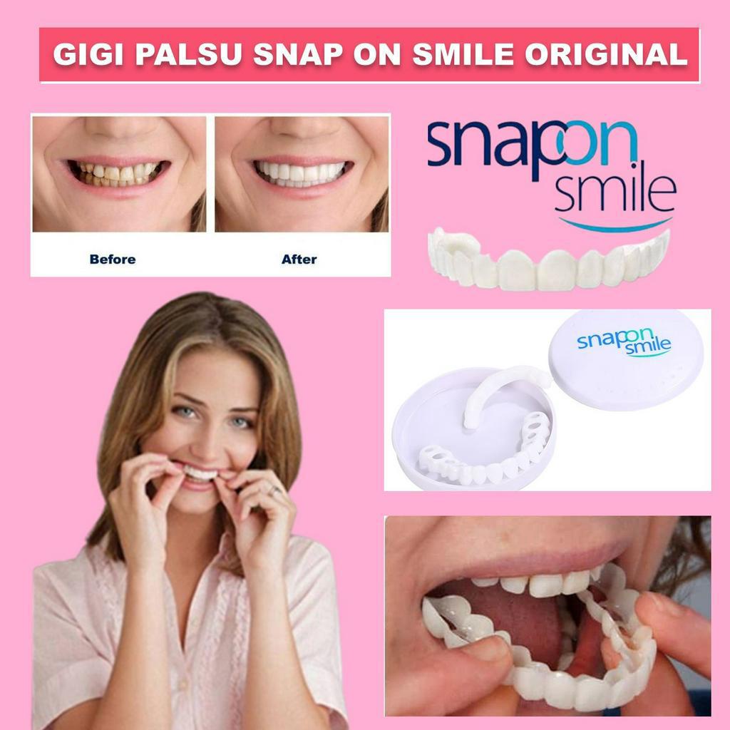 Jual Snap On Smile Gigi Palsu Instan 1 Set Atas Bawah 100% Original ...
