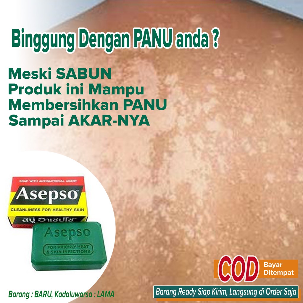 Jual Sabun Pembersih PANU Penghilang PANU Gatal jamur Kulit AMPUH murah ...