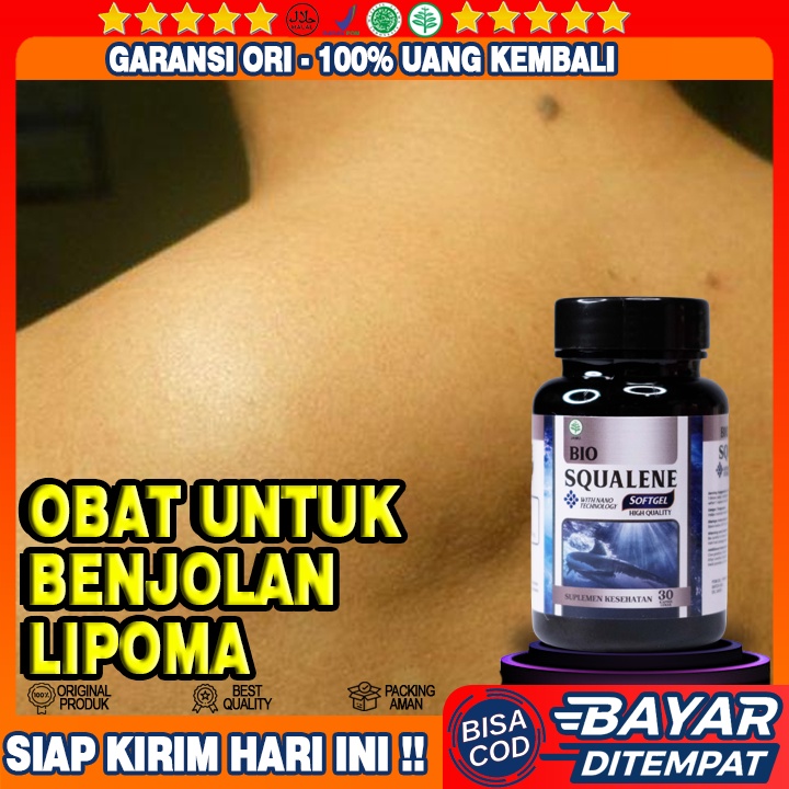 Jual Obat Benjolan Lipoma - Obat Benjolan Di Leher - Obat Benjolan Asam ...