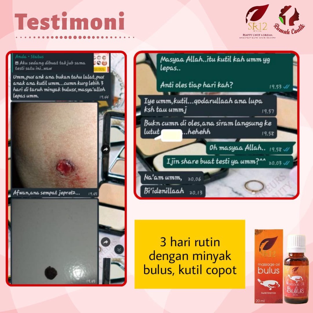 Jual SR12 MINYAK BULUS MASSAGE OIL ASLI ORIGINAL BPOM WANGI MELATI ...