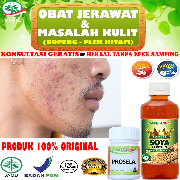 Jual Obat Jerawat BPOM Naturindo 100% Herbal Alami PROSELA SOYA CAIR ...