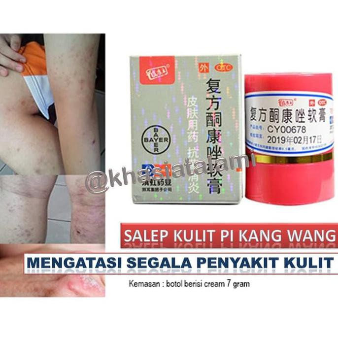 Jual 100 Asli Pi Kang Wang Salep Hl Kl Obat Penyakit Kulit Paling