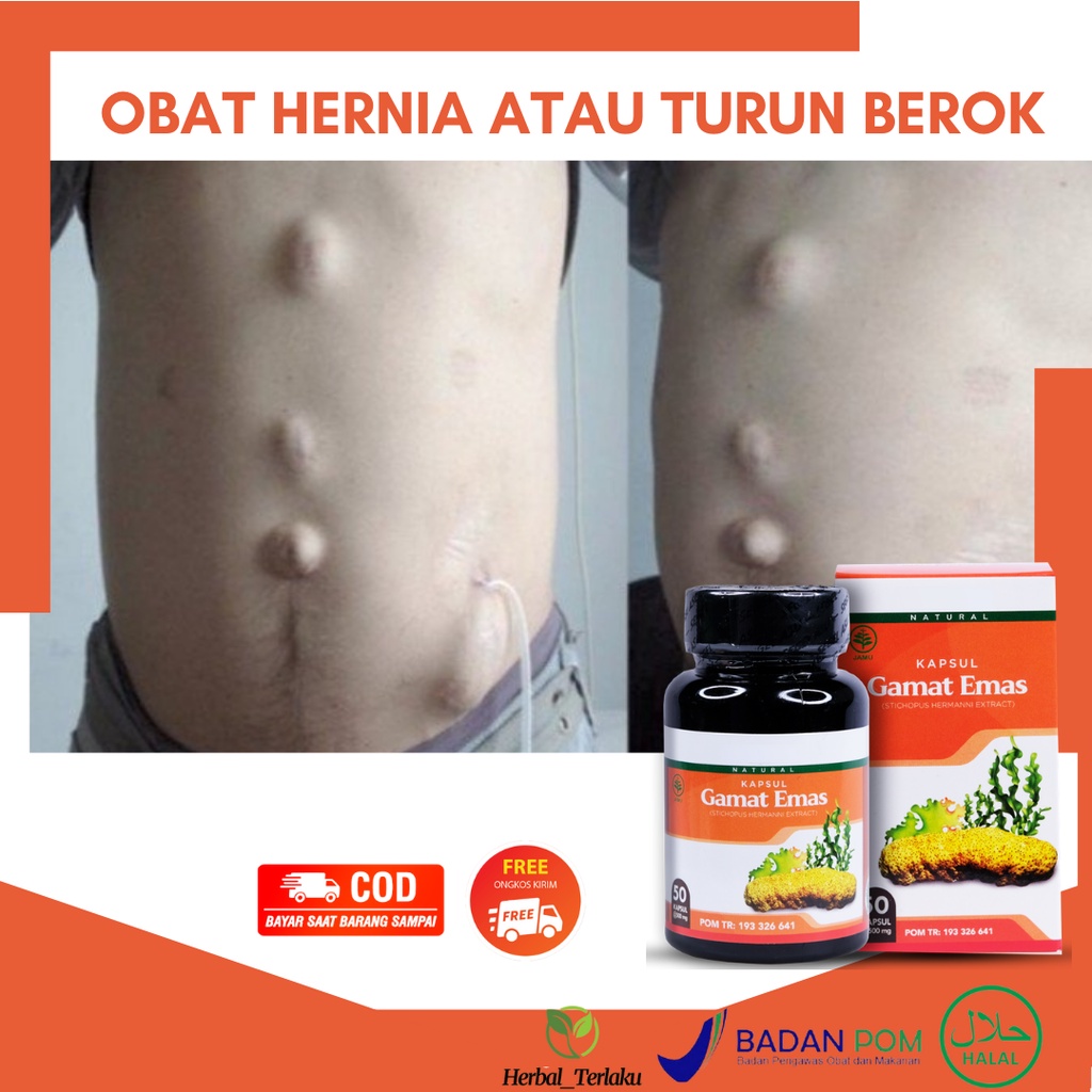 Jual Obat Turun Berok Hernia Pada Anak Dewasa, Buah Zakar Bengkak Nyeri