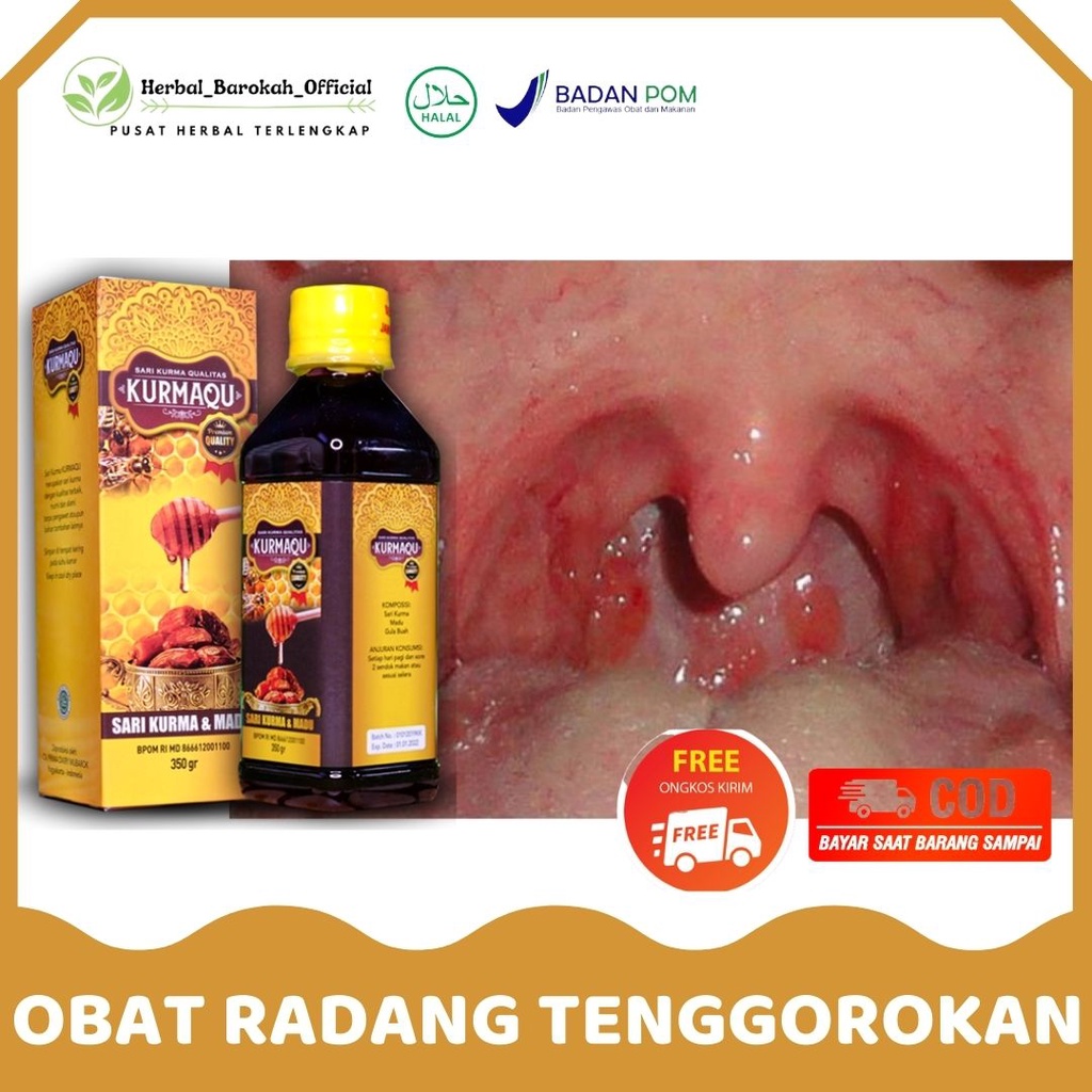 Jual Obat Radang Tenggorokan Herbal - Nyeri Tenggorokan - Kering ...