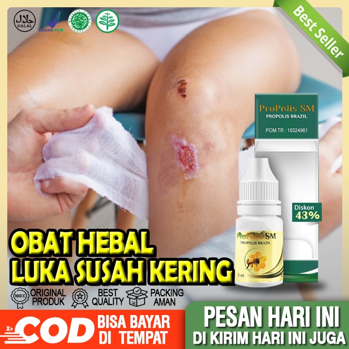 Jual Obat Pengering Bekas Luka Luka Susah Kering Obat Penyembuh Luka