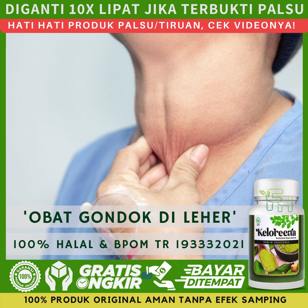 Jual Obat Gondok Beracun Gondok Di Leher Gondongan Pengempis Gondok