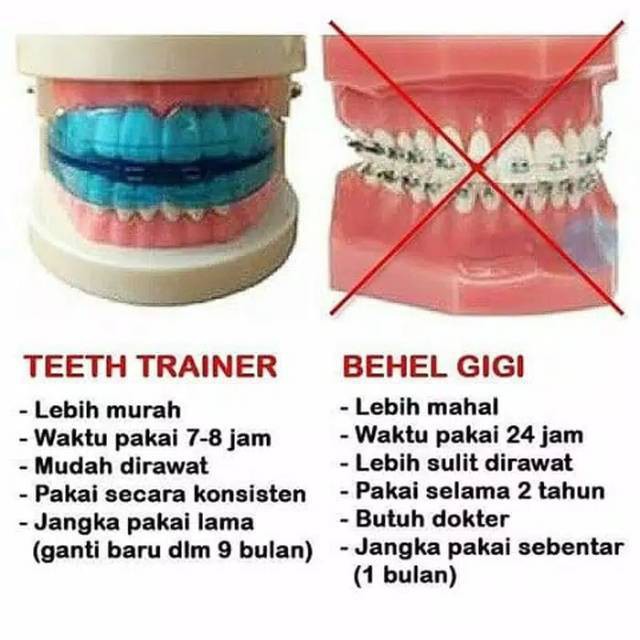 Jual Behel Gigi Orthodentic Retainer Teeth Trainer Alignment Perapi ...