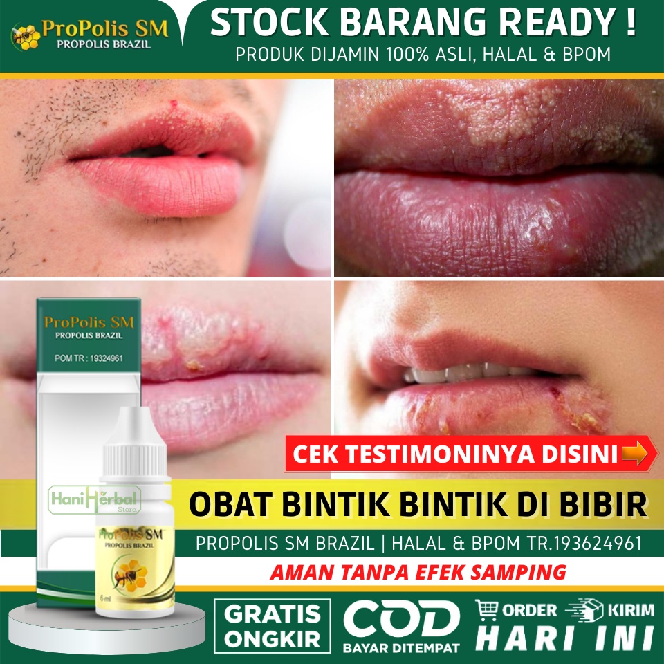 Jual Obat Bintik Bintik Putih Di Bibir Obat Oles Penghilang Bintik