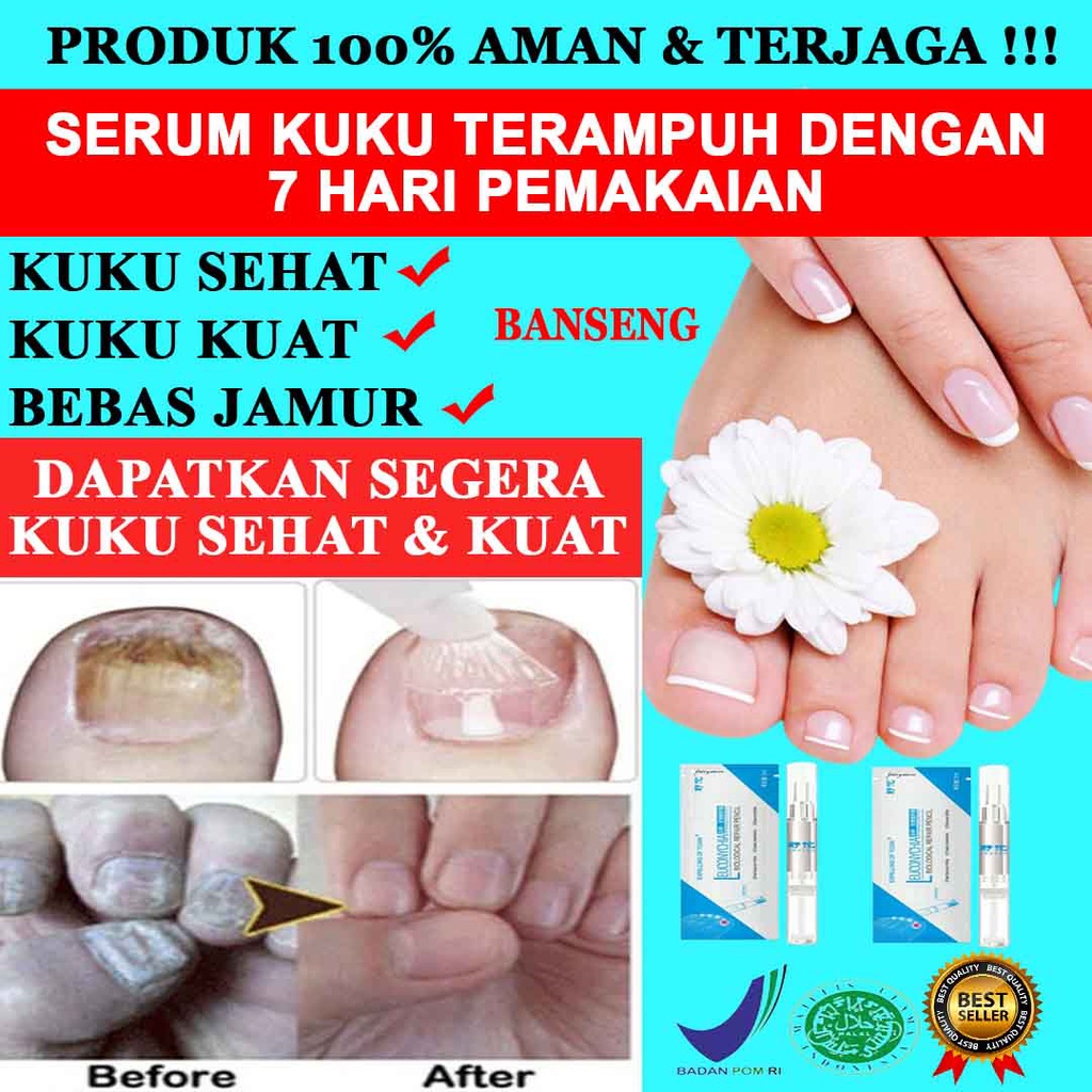 Jual Serum Kuku Anti Jamur Anti Bakteri Obat Kuku Cantengan Serum Kuku
