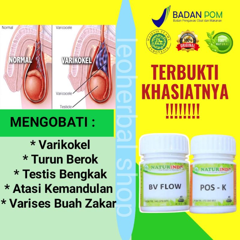 Jual Obat Varikokel Obat Herbal Buah Zakar Bengkak Nyeri Testis Turun