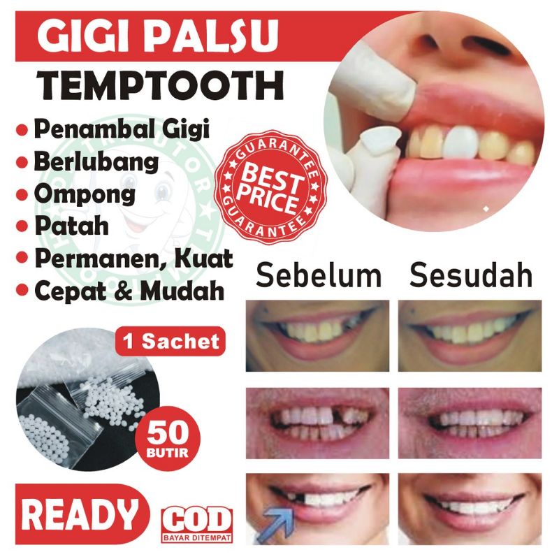 Jual GIGI PALSU SEMENTARA HARGA 50 BUTIR / PENAMBAL GIGI PATAH RENGGANG