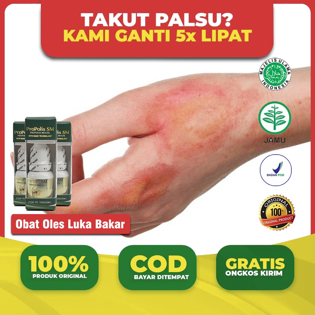 Jual Obat Oles Luka Bakar Pengering Luka Basah Jamur Hapur Gatal