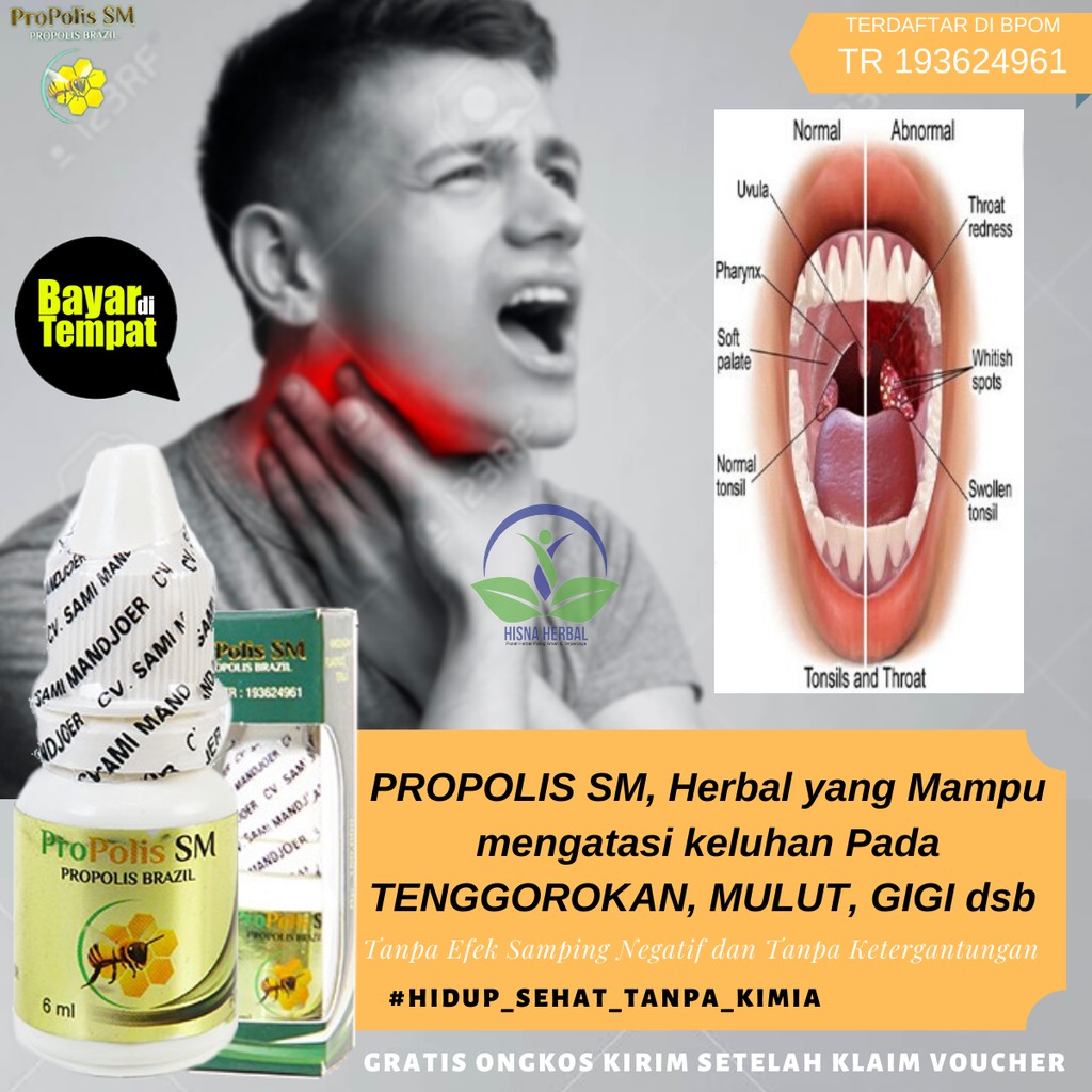 Jual OBAT TETES GUSI BENGKAK DAN GIGI SENSITIF, PENYEMBUH TERASA NGILU ...