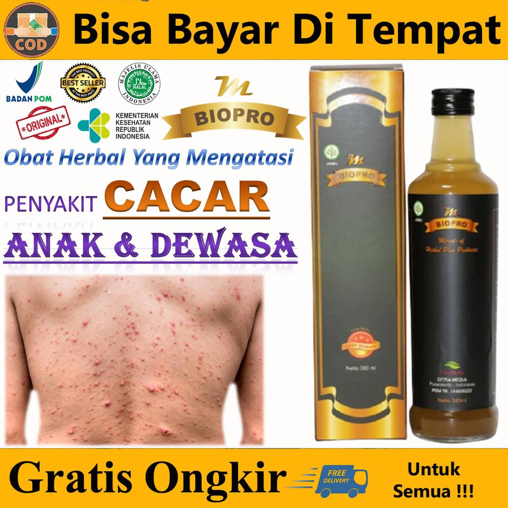 Jual Obat Cacar Air, Api, Bekas, Monyet, Ular, Anak & Dewasa Paling ...