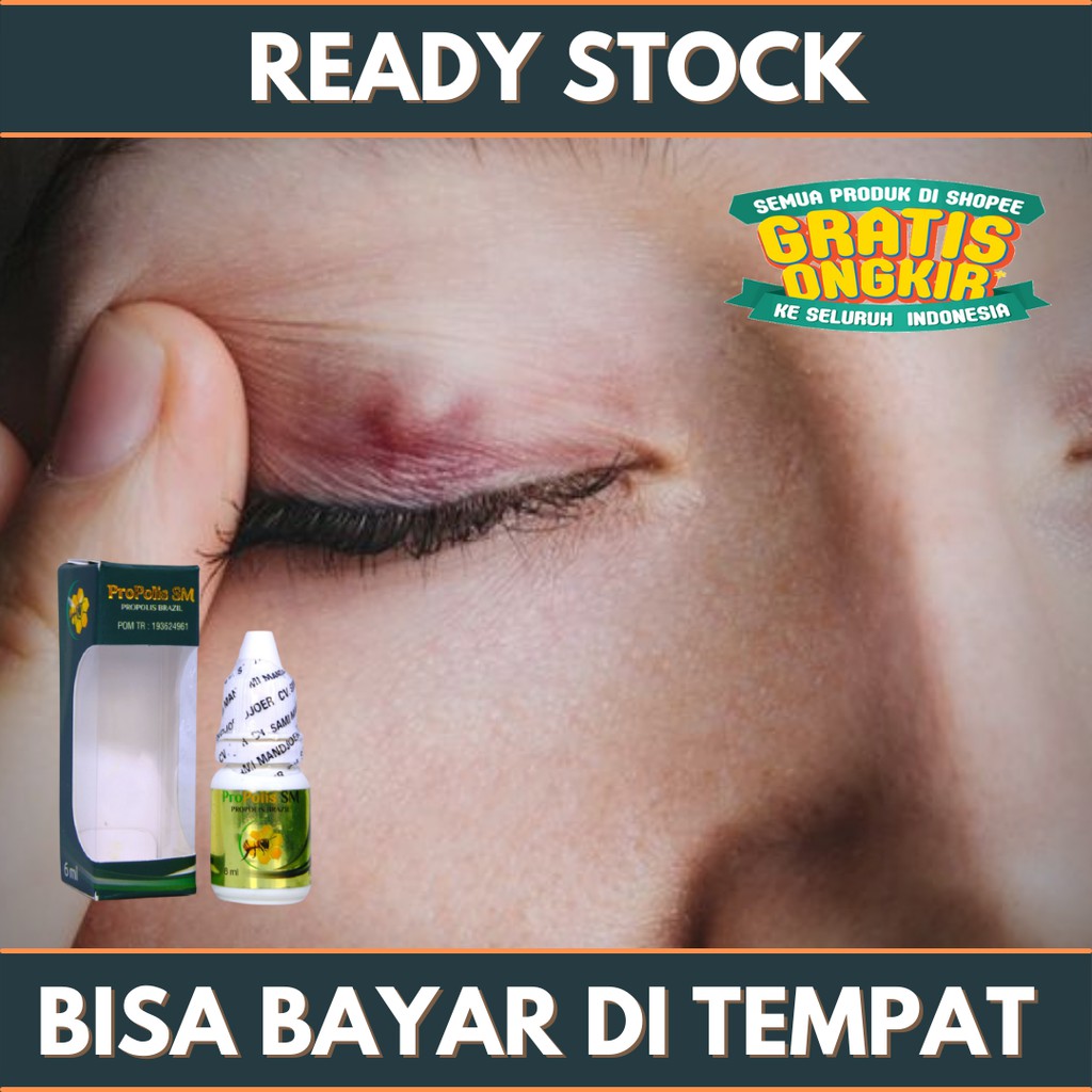 Jual Obat Penghilang Benjolan Di Kelopak Mata Obat Mata Bintitan Obat