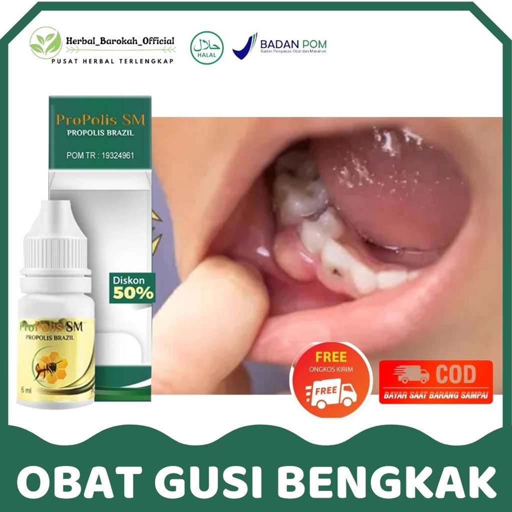 Jual Obat Gusi Bengkak - Berdarah - Benjolan Gusi Bernanah - Gusi Turun ...