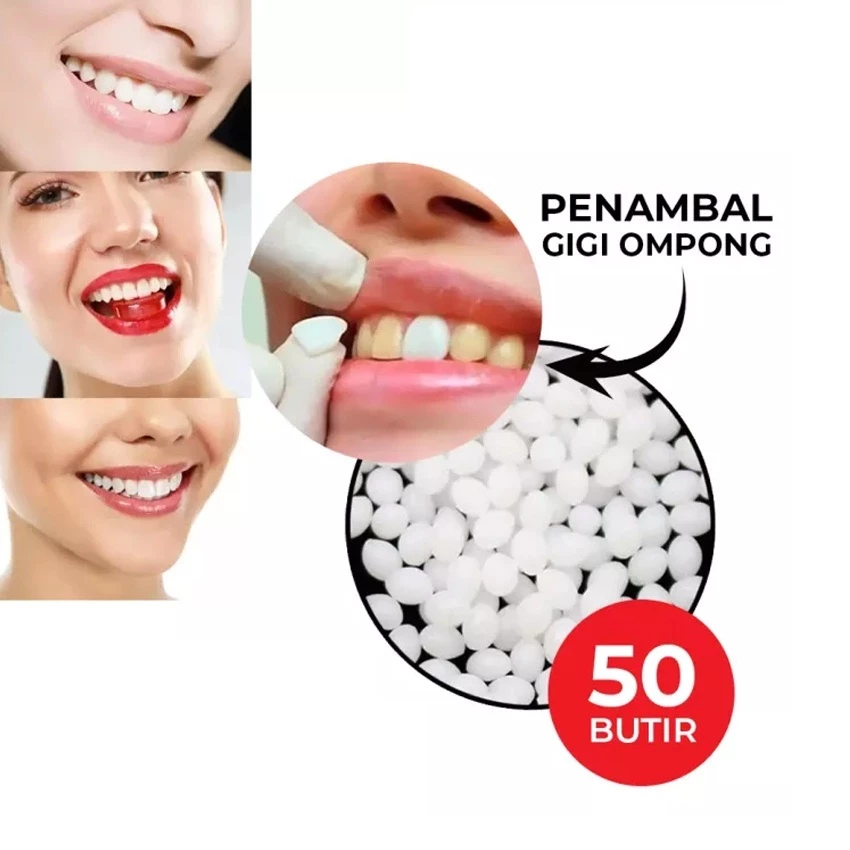 HOPE STORE - BISA COD - GIGI PALSU BUAT SENDIRI / TEMPTOOTH  PENAMBAL GIGI OMPONG PATAH RENGGANG | AutoStock