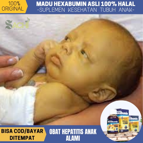 Jual Obat Hepatitis Anak, Hepatitis A B C Akut Kronis, Mengatasi ...