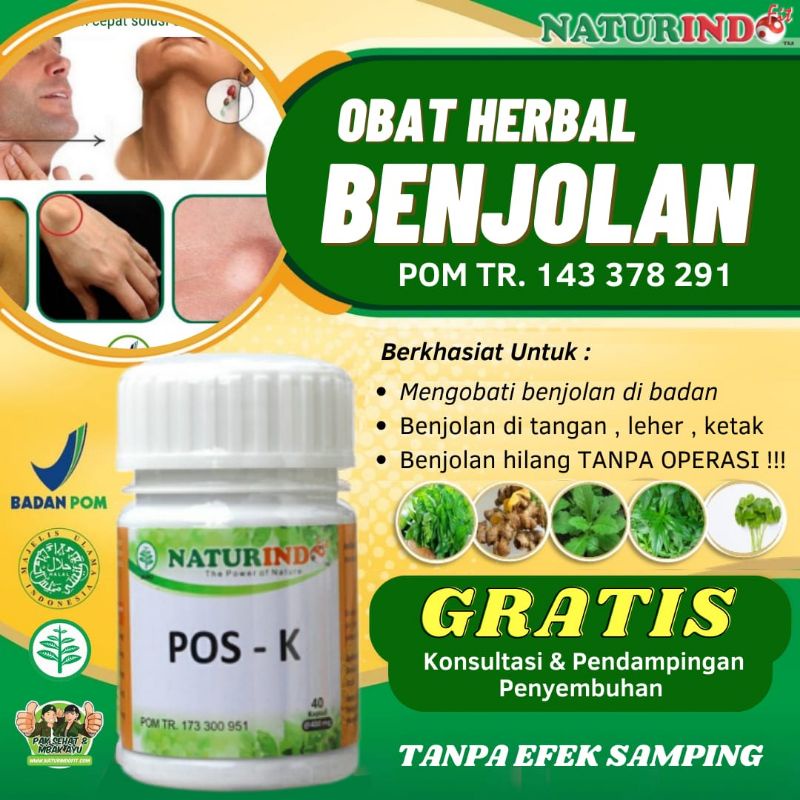 Jual Obat Lipoma Benjolan Uci Uci Benjolan Ketiak Tangan Tubuh Benjolan ...