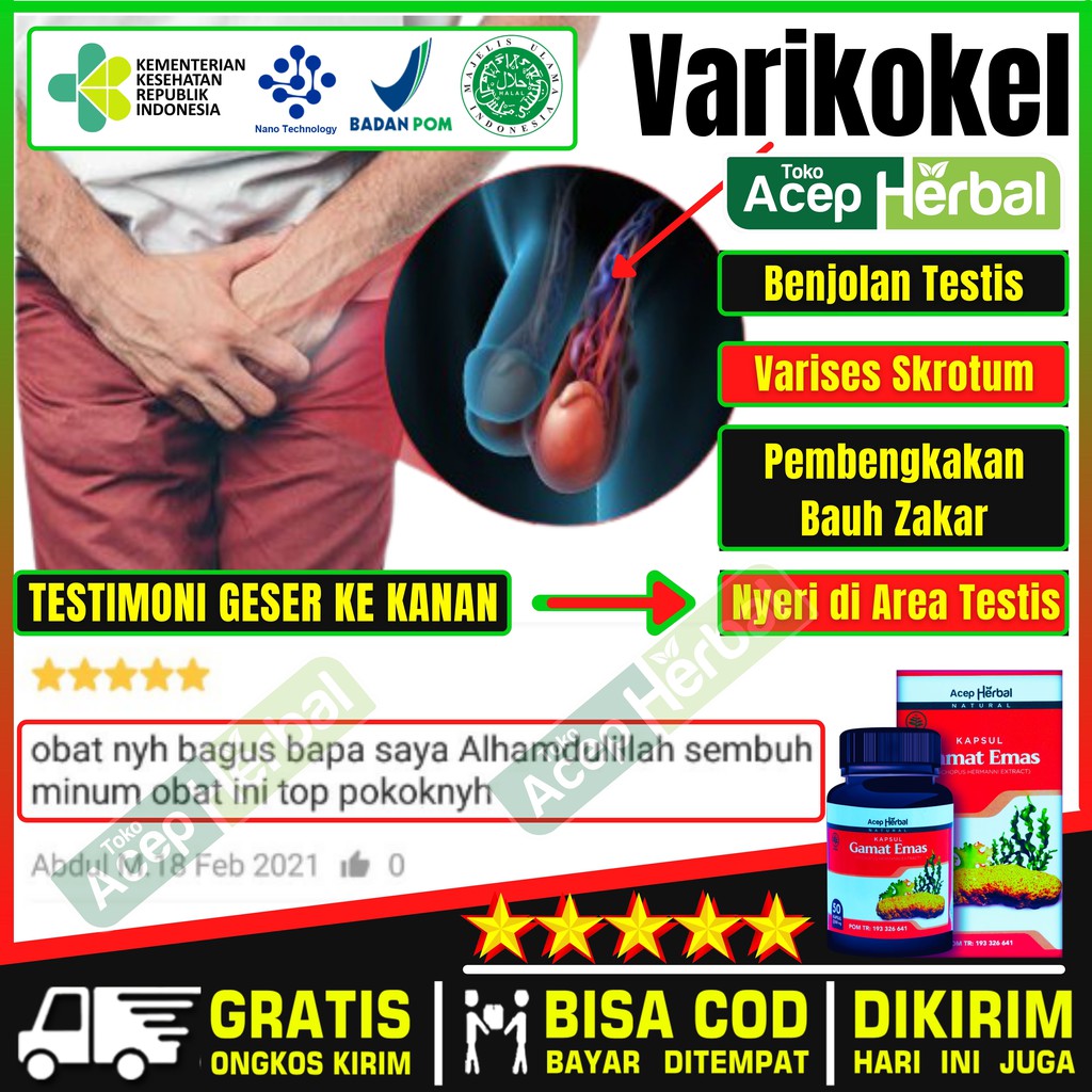 Jual Obat Testis Besar Sebelah Buah Zakar Bengkak Varikokel Hidrokel