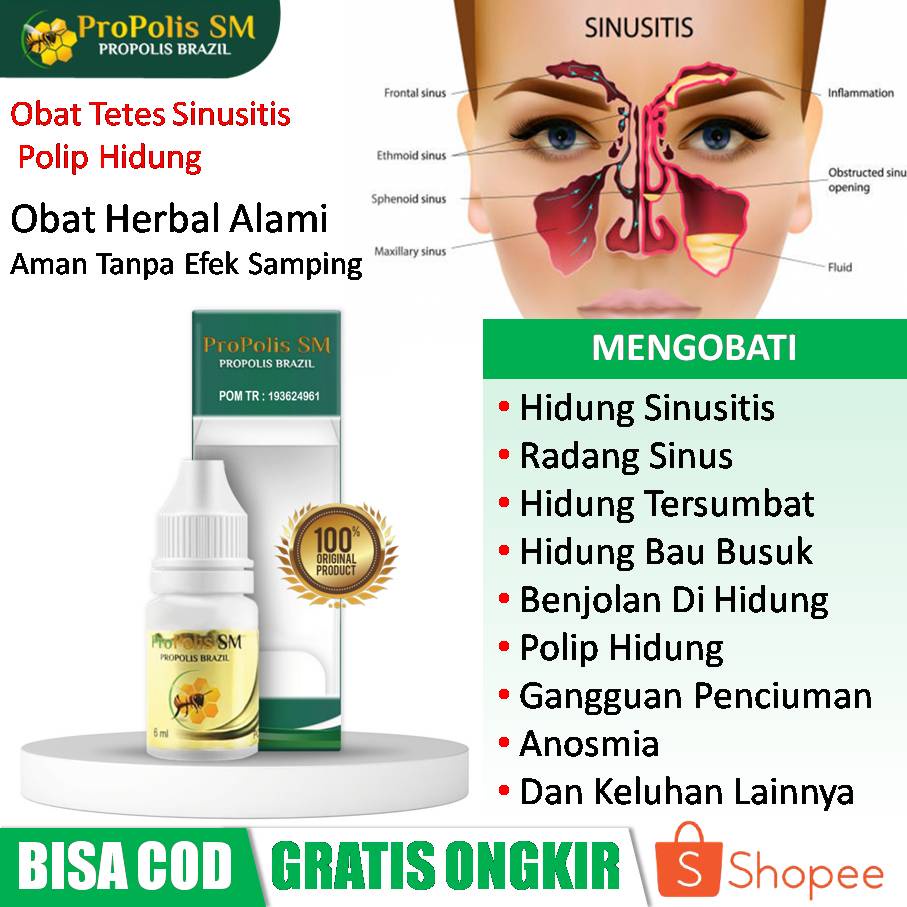 Jual Obat Tetes Sinusitis, Sinusitis Akut / Kronis, Radang Sinus ...