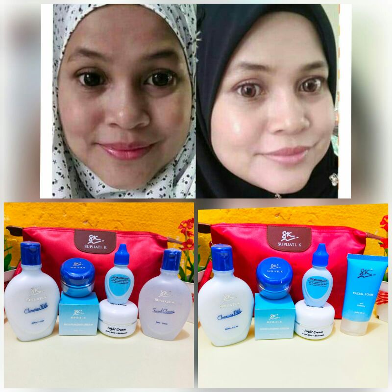 Jual Paket Whitening Untuk Wajah Kebal Skincare Dr Supijati Shopee Indonesia