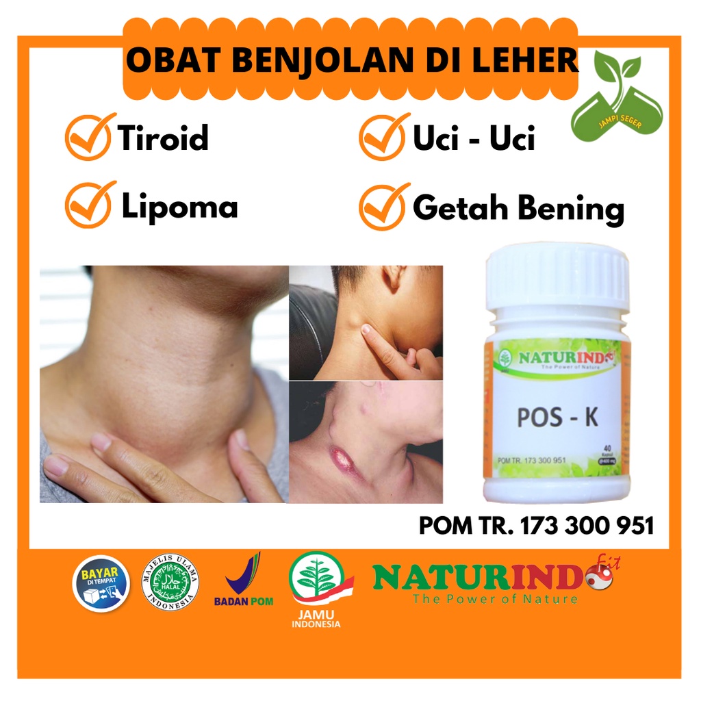 Jual Obat Benjolan Di Leher Kelenjar Getah Bening Paling Ampuh Lipoma ...