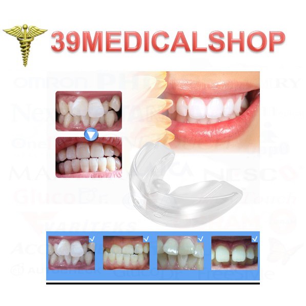 Jual ORTHODENTIC RETAINER THEETH TRAINER ALLIGNMENT-BEHEL GIGI-TERAPI ...