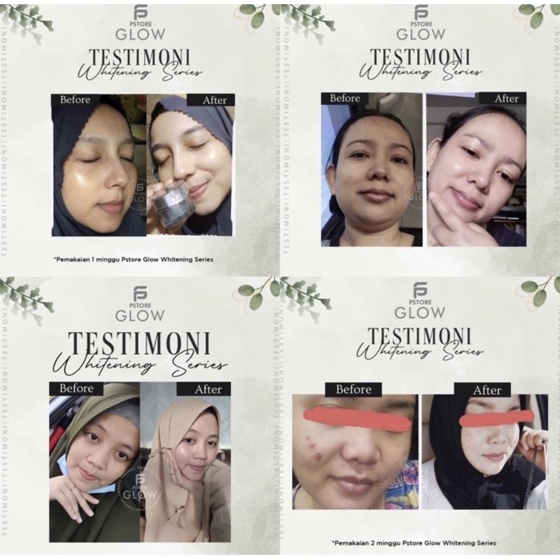 Jual Free T Pstore Glow Paket Skincare Beauty Whitening Series Paket Komplit Untuk 2213