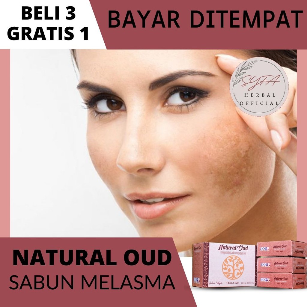 Jual Natural Oud Sabun Penghilang Flek Melasma, Flek Hitam, Noda Hitam ...