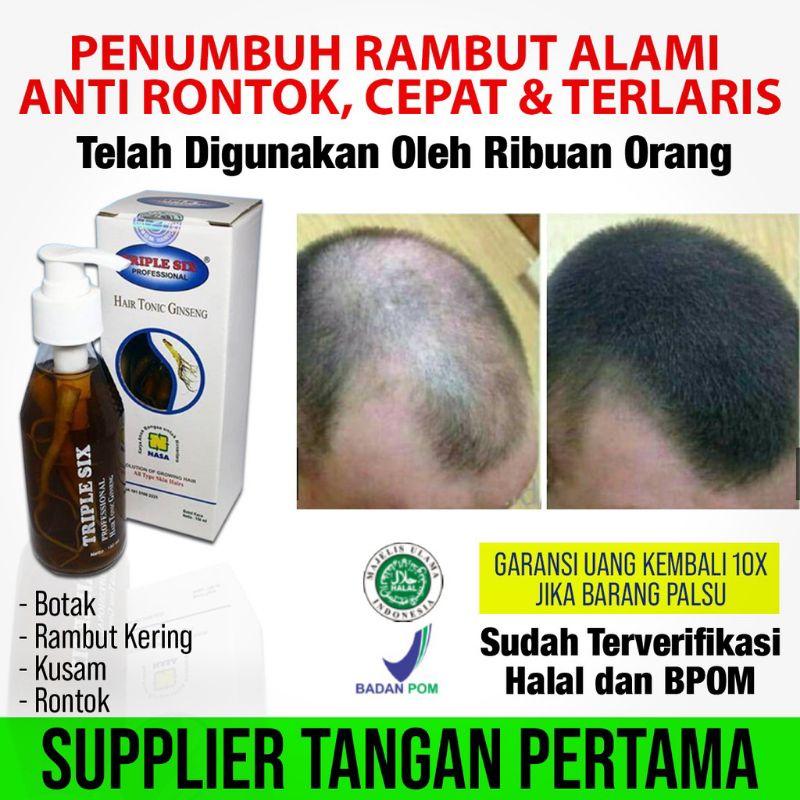 Jual TRIPLE SIX NASA Menyuburkan Rambut Yang Botak Asli Original Nasa ...