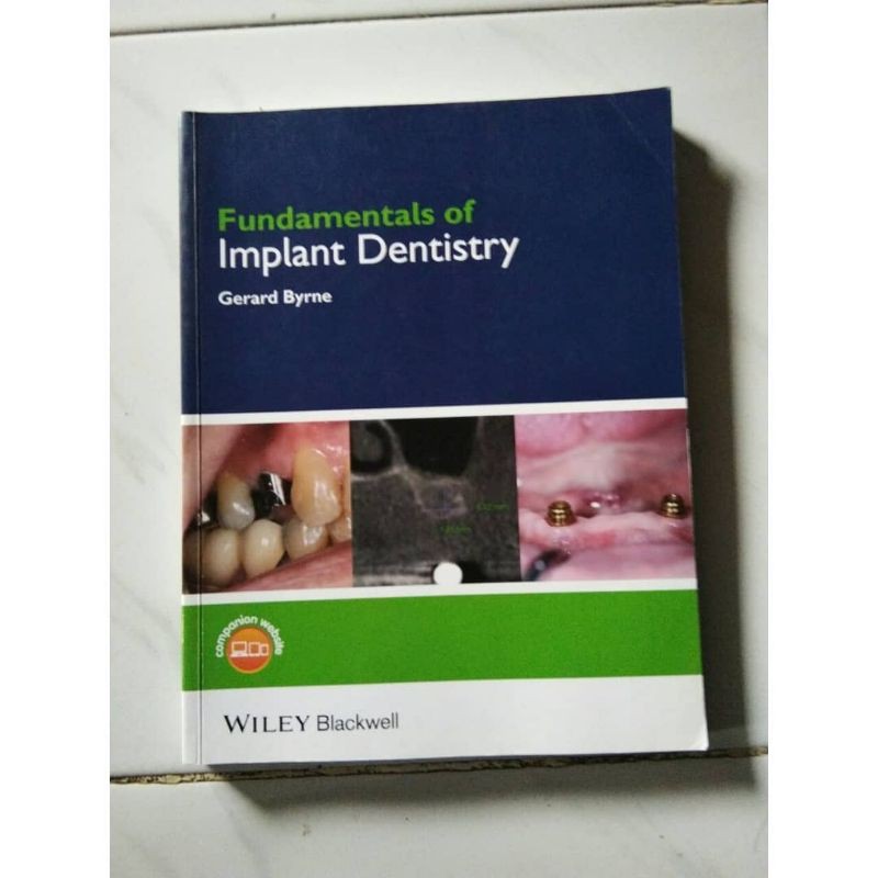 Jual Fundamentals of Implant Dentistry | Shopee Indonesia