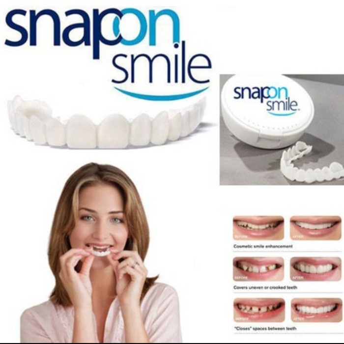 Jual Snap On Smile Denture Elastic Removable Veneer Teeth Gigi Palsu