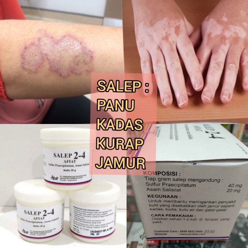 Jual 15 gram SALEP SULFUR 2-4 AFIAT PANU KADAS KURAP JERAWAT | Shopee ...