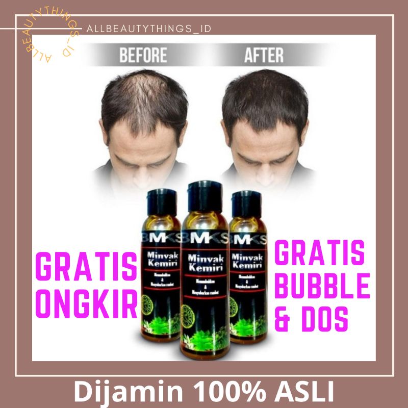 Jual Minyak Kemiri BMKS Asli Obat Penumbuh Rambut Botak Penyubur Rambut ...