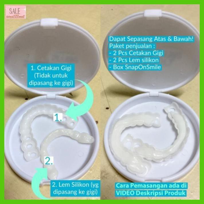 Jual Igigputih Snap On Smile Denture Elastic Removable Veneer Teeth