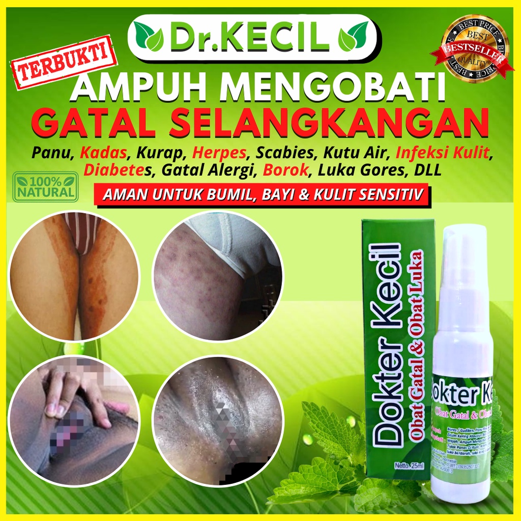 Jual Obat Gatal Selangkangan Eksim Dan Jamur Paling Ampuh Spray Dr