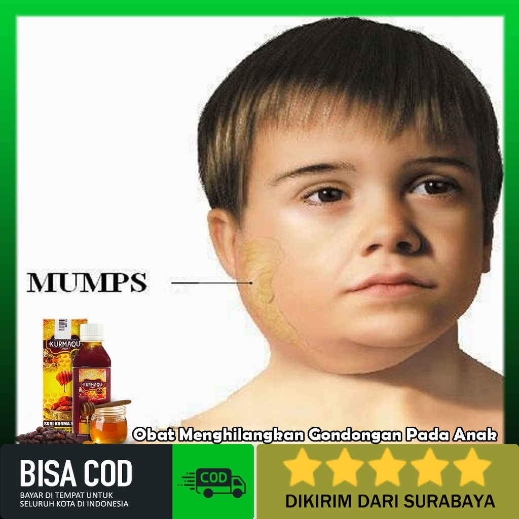 Jual KURMAQU Obat Untuk Menghilangkan Gondongan Pada Anak/Benjolan