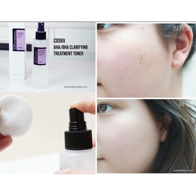 Jual cosrx AHA/BHA clarifying treatment toner 150 ml spray exfoliating