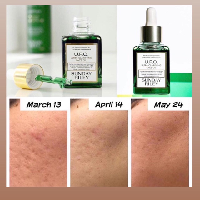 Jual Sunday Riley UFO Ultra Clarifying Oil | Shopee Indonesia