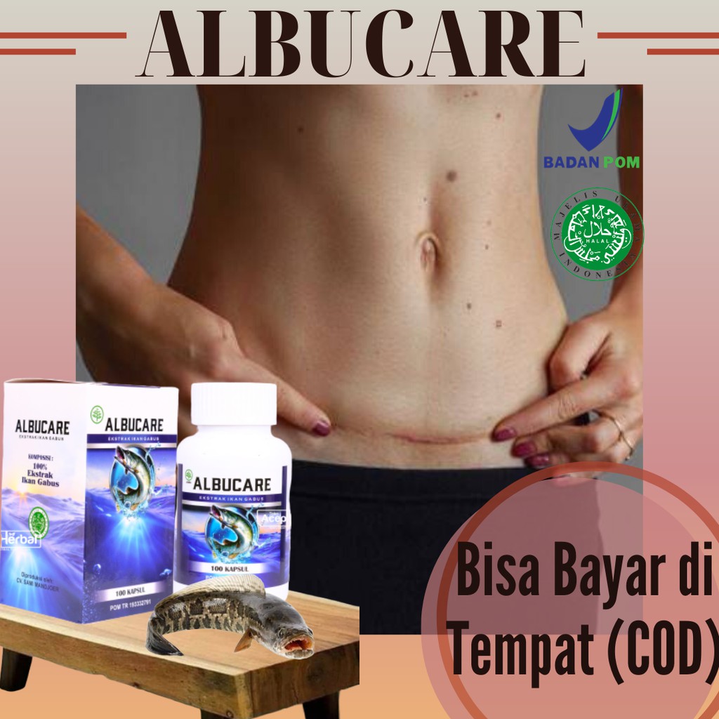 Jual Obat Luka Bekas Operasi, Luka Jahitan, Luka Operasi Caesar, Luka ...