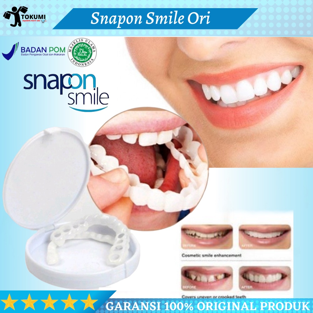 Jual Gigi Palsu Instan Atas Bawah Snap On Smile Original Shopee Indonesia