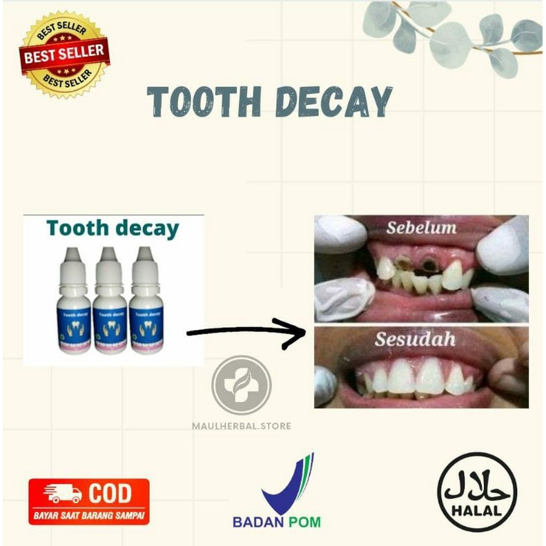 Jual TOOTH DECAY ( PENUMBUH GIGI, PENGHILANG KARANG GIGI, GIGI KROPOS