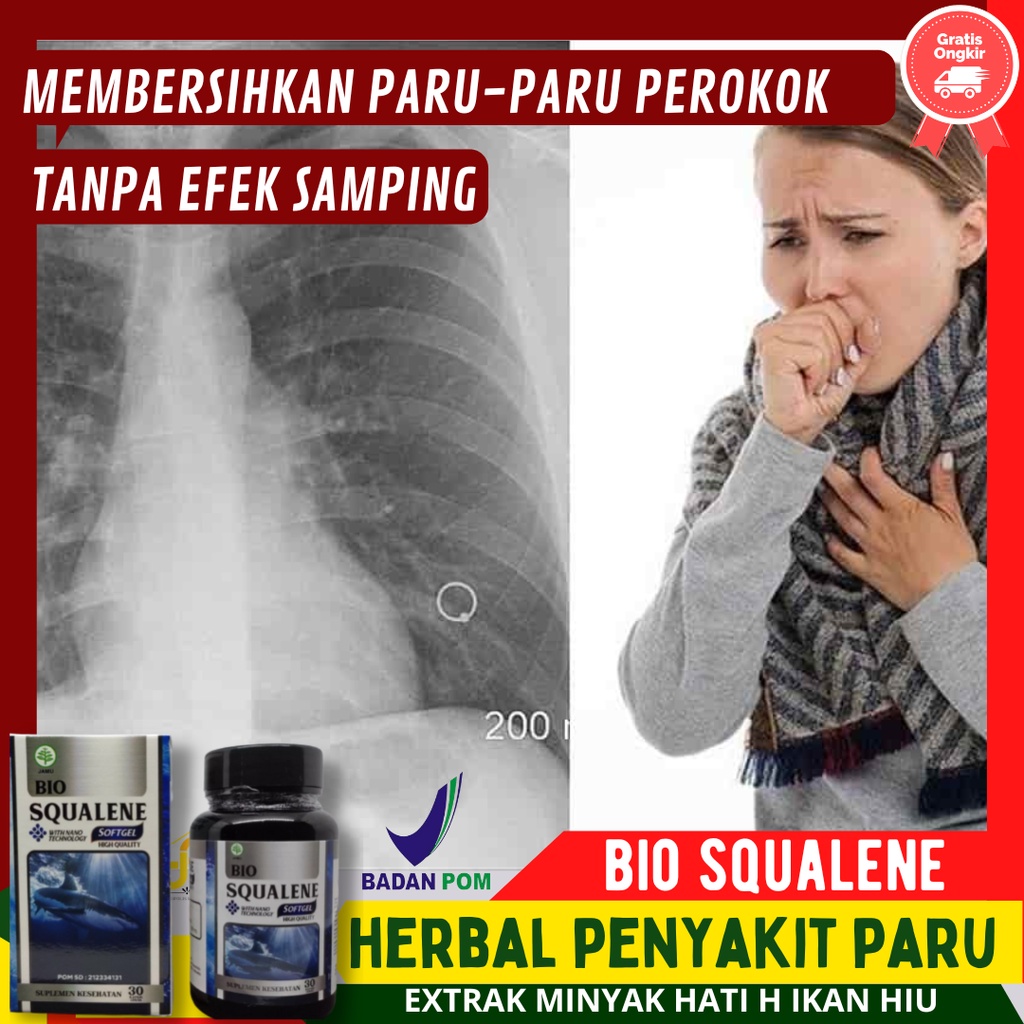 Jual Cara membersihkan paruparu perokok Obat Sakit Paru Paru Akibat