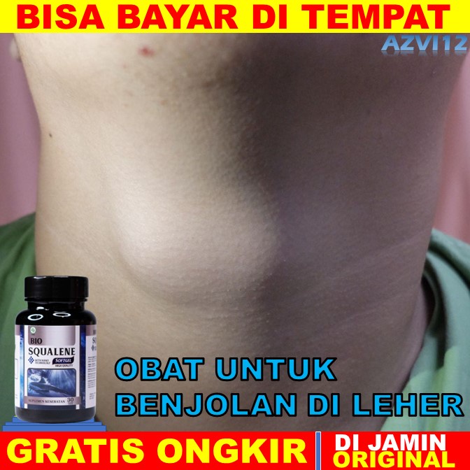 Jual Obat Benjolan Di Leher Herbal Benjolan Di Leher Obat Benjolan Di Leher Obat Benjolan Di