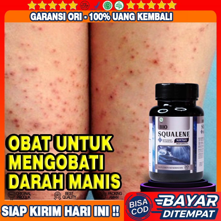 Jual Obat Darah Manis Gatal Prurigo Obat Kulit Gatal Gatal Obat