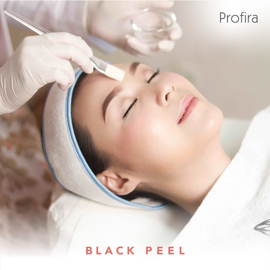 Jual Profira Black Peel | Shopee Indonesia