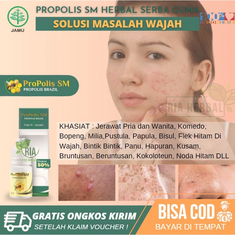 Jual OBAT PENGHILANG MILIA HERBAL ALAMI, OBAT MENGHILANGKAN BENJOLAN ...