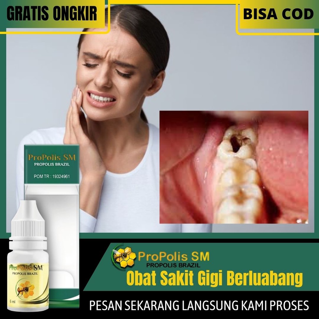 Jual Obat Sakit gigi berlubang, gusi bengkak, untuk anak dan Dewasa