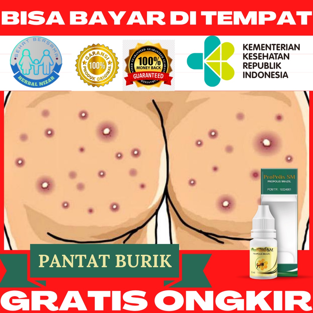 Jual Obat Tetes Penghilang Bekas Koreng Di Pantat Obat Pantat Burik Pantat Bruntusan Bintik